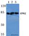Carboxypeptidase N subunit 2 antibody, A05815-1, Boster Biological Technology, Western Blot image 