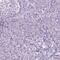 Gamma-Aminobutyric Acid Type A Receptor Beta2 Subunit antibody, PA5-64331, Invitrogen Antibodies, Immunohistochemistry paraffin image 