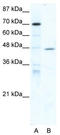 Nuclear receptor subfamily 2 group F member 6 antibody, TA332066, Origene, Western Blot image 