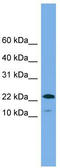 WAP Four-Disulfide Core Domain 1 antibody, TA344732, Origene, Western Blot image 