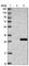 Abhydrolase Domain Containing 14B antibody, HPA036642, Atlas Antibodies, Western Blot image 