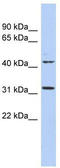 Methyltransferase Like 6 antibody, TA330974, Origene, Western Blot image 