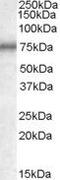 Methylphosphate Capping Enzyme antibody, PA5-18854, Invitrogen Antibodies, Western Blot image 