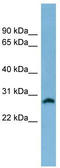 Steroid 5 Alpha-Reductase 2 antibody, TA335224, Origene, Western Blot image 