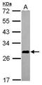 Ankyrin Repeat And SOCS Box Containing 7 antibody, GTX119040, GeneTex, Western Blot image 