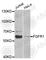 Fibroblast Growth Factor Receptor 1 antibody, A2073, ABclonal Technology, Western Blot image 
