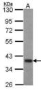 Forkhead box protein B1 antibody, PA5-28134, Invitrogen Antibodies, Western Blot image 