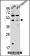 Sorting Nexin 29 antibody, 56-999, ProSci, Western Blot image 