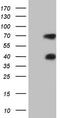 Mesothelin antibody, CF805260, Origene, Western Blot image 