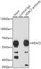 Histone Deacetylase 2 antibody, GTX65924, GeneTex, Immunoprecipitation image 