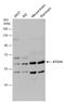 Barkor antibody, GTX128166, GeneTex, Western Blot image 
