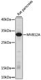 Multivesicular Body Subunit 12A antibody, 16-330, ProSci, Western Blot image 