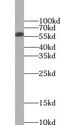 UTP15 Small Subunit Processome Component antibody, FNab09348, FineTest, Western Blot image 