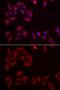 Pyridoxal kinase antibody, GTX33400, GeneTex, Immunocytochemistry image 