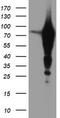 Epsin 2 antibody, TA504296S, Origene, Western Blot image 