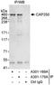 Centrosomal Protein 350 antibody, A301-170A, Bethyl Labs, Immunoprecipitation image 
