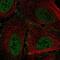 AT-Rich Interaction Domain 1B antibody, NBP2-57946, Novus Biologicals, Immunofluorescence image 