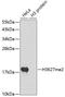 Histone Cluster 3 H3 antibody, A2362, ABclonal Technology, Western Blot image 