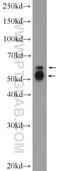 Phosphoprotein associated with glycosphingolipid-enriched microdomains 1 antibody, 25029-1-AP, Proteintech Group, Western Blot image 