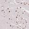 Ripply Transcriptional Repressor 3 antibody, HPA055541, Atlas Antibodies, Immunohistochemistry paraffin image 