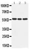 Cytochrome P450 Family 2 Subfamily D Member 6 antibody, PA1397, Boster Biological Technology, Western Blot image 