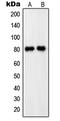 Phosphodiesterase 4C antibody, LS-C352636, Lifespan Biosciences, Western Blot image 