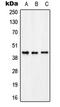 Potassium Voltage-Gated Channel Subfamily A Regulatory Beta Subunit 3 antibody, LS-C353145, Lifespan Biosciences, Western Blot image 