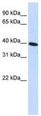 NAD(P)HX Dehydratase antibody, TA342362, Origene, Western Blot image 