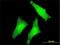 Ubiquitin carboxyl-terminal hydrolase 3 antibody, H00009960-M01, Novus Biologicals, Immunocytochemistry image 