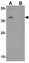 DnaJ Heat Shock Protein Family (Hsp40) Member A4 antibody, GTX31615, GeneTex, Western Blot image 