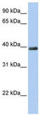 Zinc Finger Protein 391 antibody, TA339667, Origene, Western Blot image 