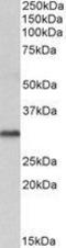 Voltage-dependent anion-selective channel protein 2 antibody, GTX89782, GeneTex, Western Blot image 