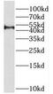 Protein Arginine Methyltransferase 8 antibody, FNab06793, FineTest, Western Blot image 
