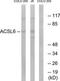 Long-chain-fatty-acid--CoA ligase 6 antibody, TA315237, Origene, Western Blot image 