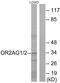 Olfactory receptor 2AG1 antibody, PA5-38166, Invitrogen Antibodies, Western Blot image 