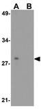 Ring Finger Protein 121 antibody, GTX17248, GeneTex, Western Blot image 