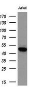 Lysyl Oxidase antibody, M00575-3, Boster Biological Technology, Western Blot image 