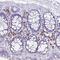 Farnesyltransferase, CAAX Box, Beta antibody, PA5-64061, Invitrogen Antibodies, Immunohistochemistry frozen image 