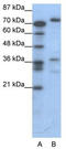 CAMP Responsive Element Binding Protein 3 antibody, TA331155, Origene, Western Blot image 