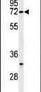 Synoviolin 1 antibody, PA5-24593, Invitrogen Antibodies, Western Blot image 