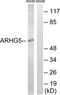 Rho guanine nucleotide exchange factor 5 antibody, TA326240, Origene, Western Blot image 