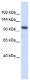 Beta-1,4-N-Acetyl-Galactosaminyltransferase 3 antibody, TA330994, Origene, Western Blot image 