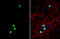 Forkhead Box G1 antibody, GTX134018, GeneTex, Immunofluorescence image 