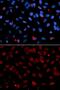 Serine And Arginine Rich Splicing Factor 1 antibody, GTX55794, GeneTex, Immunofluorescence image 