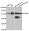 Calcium/Calmodulin Dependent Protein Kinase IV antibody, TA332597, Origene, Western Blot image 