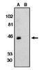 C-X-C Motif Chemokine Receptor 6 antibody, SP6323PX, Origene, Western Blot image 