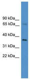 RNA polymerase II elongation factor ELL2 antibody, TA343676, Origene, Western Blot image 