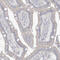 Methylenetetrahydrofolate Dehydrogenase (NADP+ Dependent) 2 Like antibody, HPA035434, Atlas Antibodies, Immunohistochemistry paraffin image 