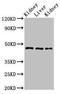 Makorin Ring Finger Protein 2 antibody, orb401104, Biorbyt, Western Blot image 