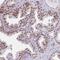 Zinc Finger BED-Type Containing 5 antibody, PA5-61747, Invitrogen Antibodies, Immunohistochemistry frozen image 